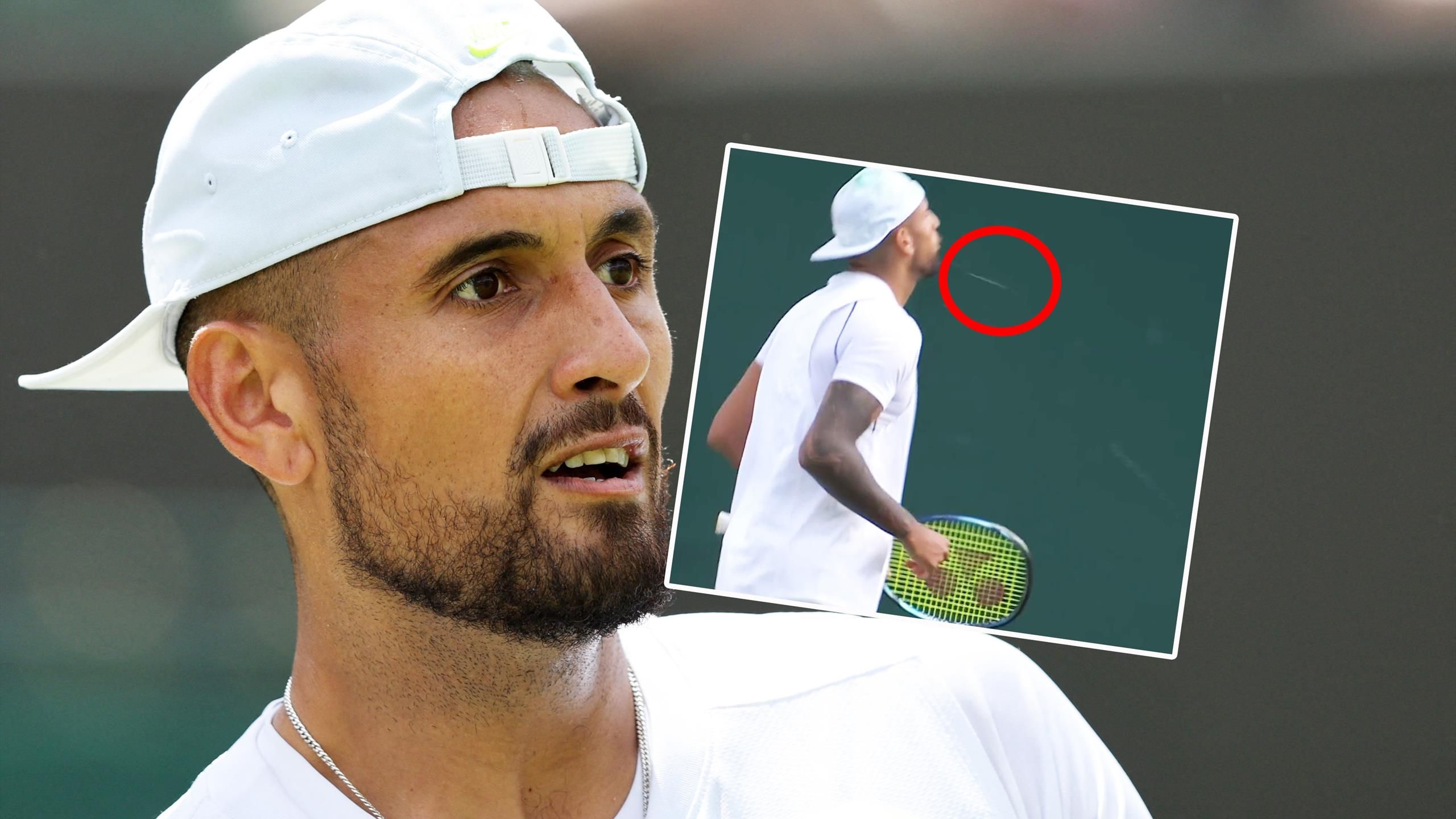 Nick Kyrgios spitting incident