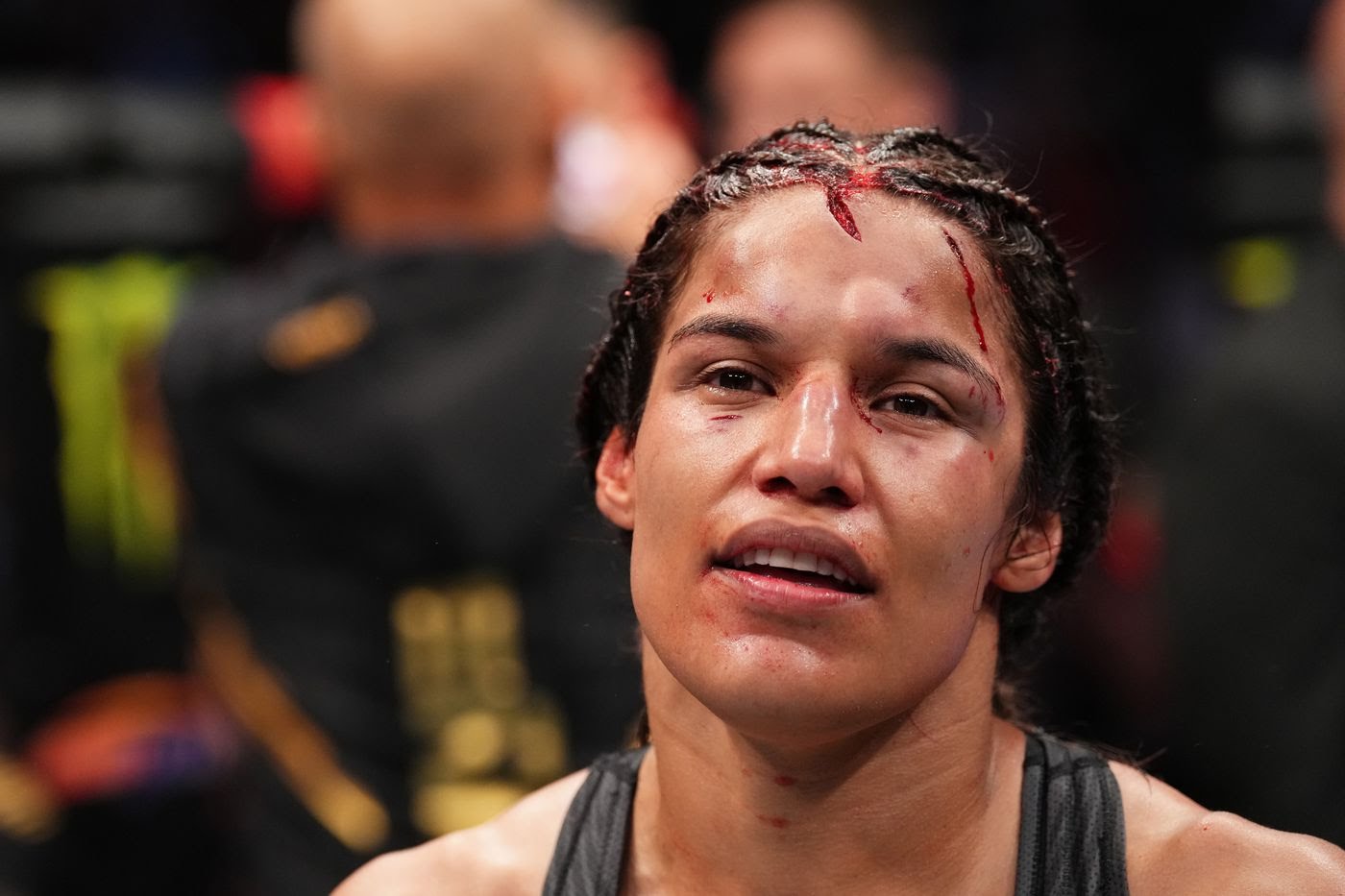 Julianna Pena bruised up after her battle with Amanda Nunes