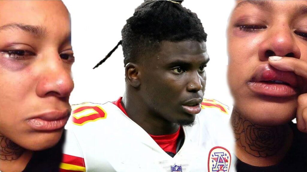 Tyreek Hill